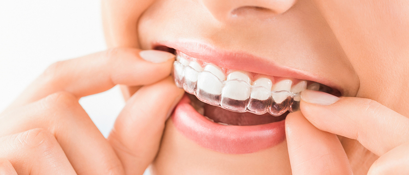Your Guide To Using Invisalign Chewies