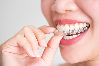 Invisalign Mississauga