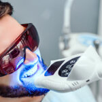 How Long Does Teeth Whitening Last? Tips for Maintaining Your Results