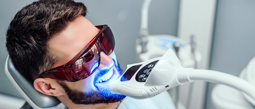 How Long Does Teeth Whitening Last? Tips for Maintaining Your Results