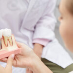 The Dental Implant Procedure: What to Expect at Every Step