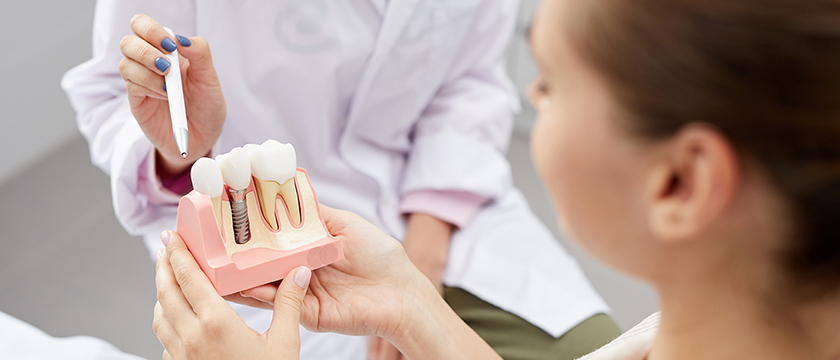 The Dental Implant Procedure: What to Expect at Every Step